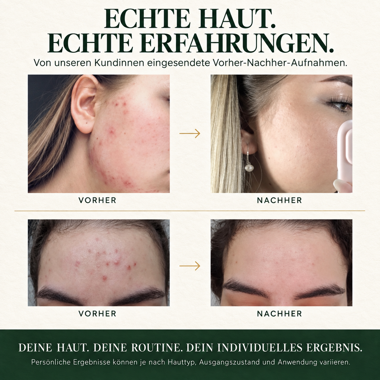 Starter Set – 4‑Schritte Gesichtspflege-Routine