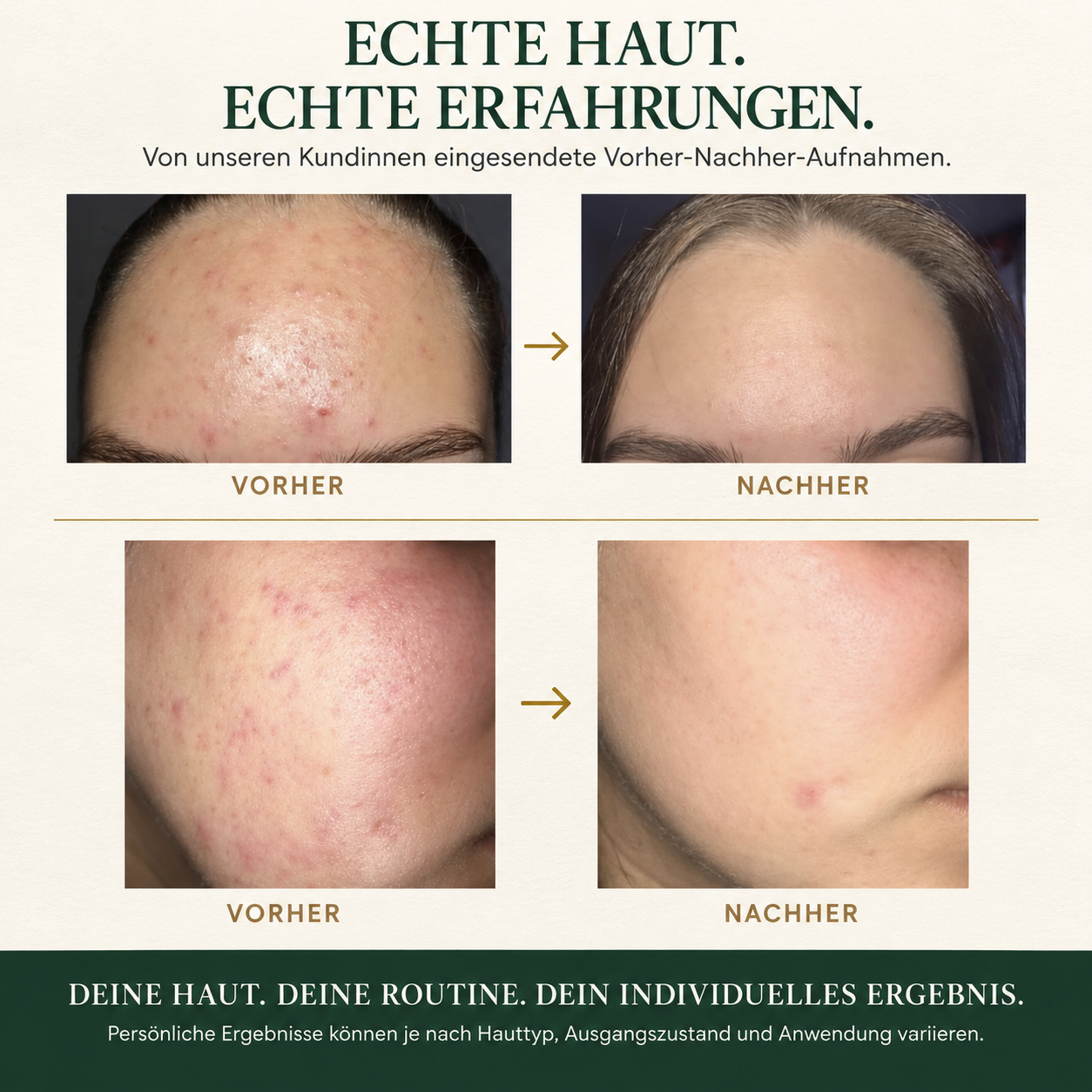 Starter Set – 4‑Schritte Gesichtspflege-Routine
